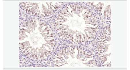 6052c79a5b6af.png image.png