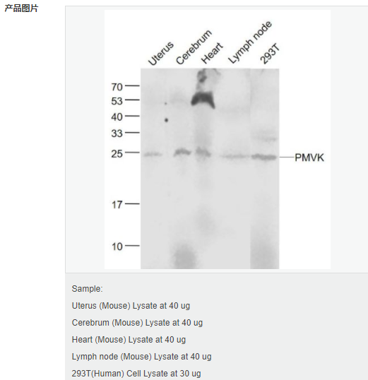 6058019b6515b.png image.png