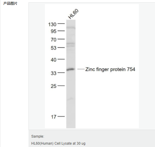 6058027b49a22.png image.png