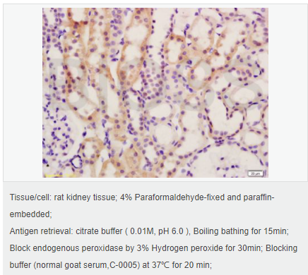 605841e47f566.png image.png