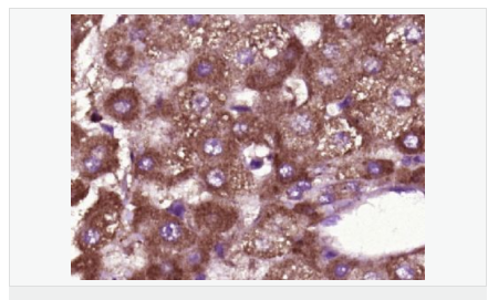 605940775029f.png image.png