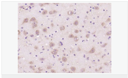 605992f5922d1.png image.png