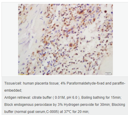 6059a75aef91e.png image.png