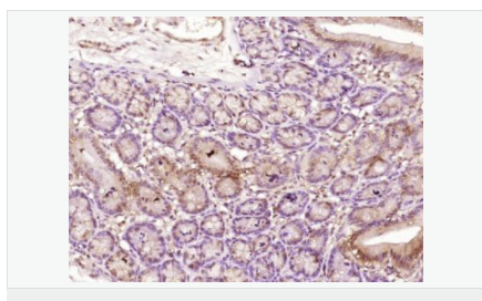 605d9334c20e1.png image.png