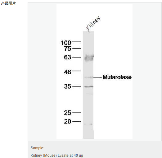 6066740a163a3.png image.png