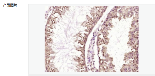 60764058e3618.png image.png